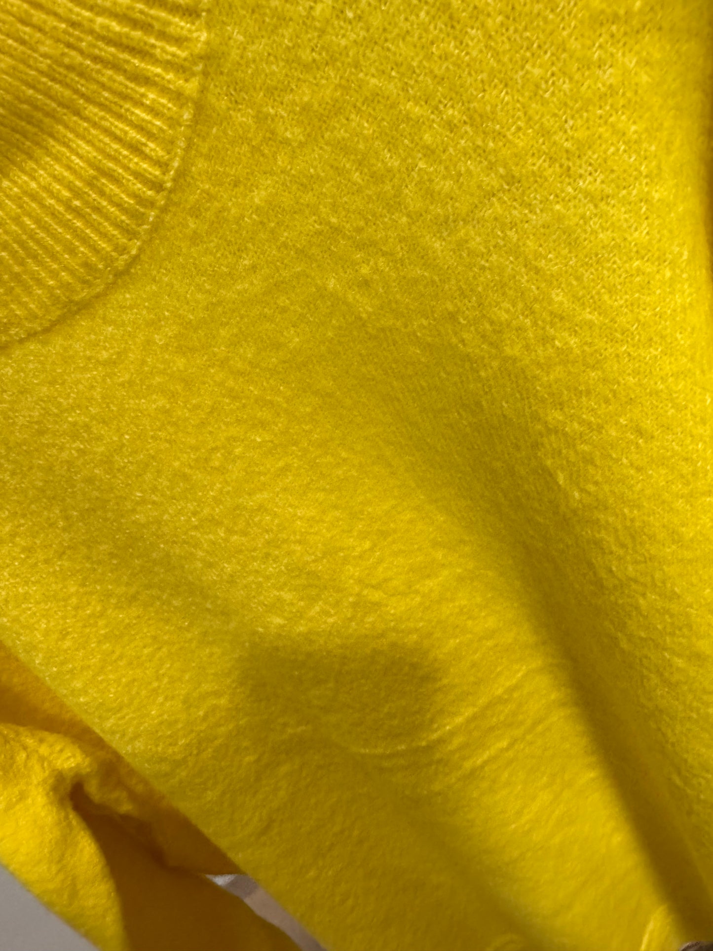 Jersey viral